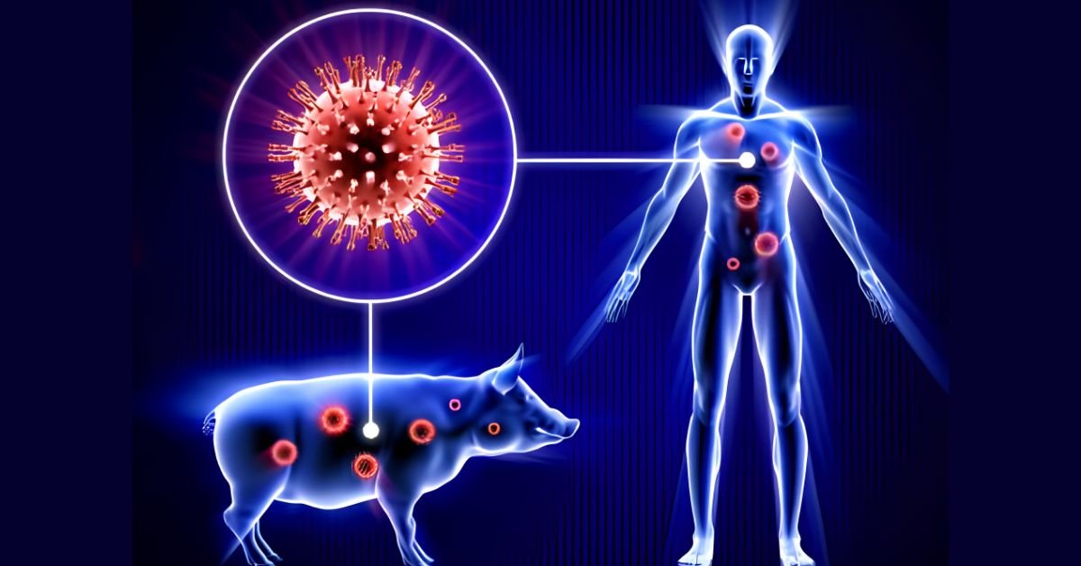 SWINE FLU IN PUNJAB : पठानकोट में मिला स्वाइन फ्लू का मरीज